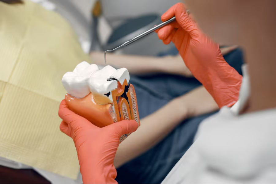 Can an Untreated Cavity Get Worse Even When It Does Not Hurt?