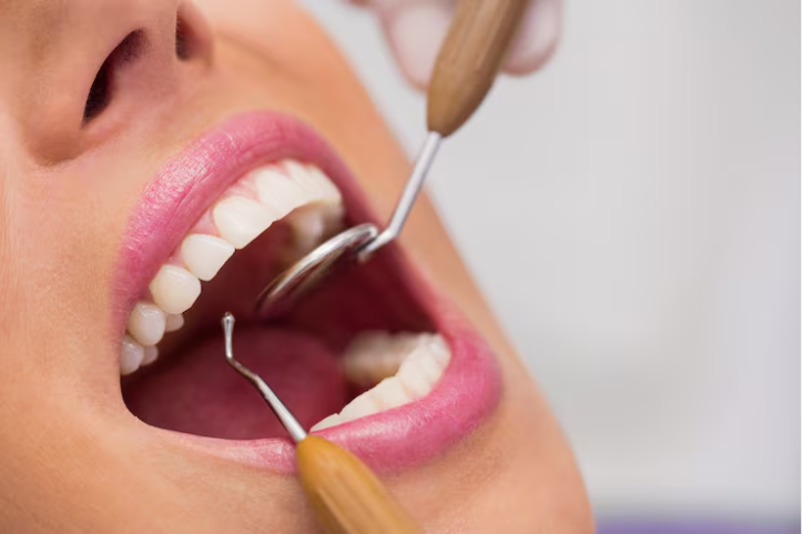 Can Fewer Dental Implants Replace Several Missing Teeth?